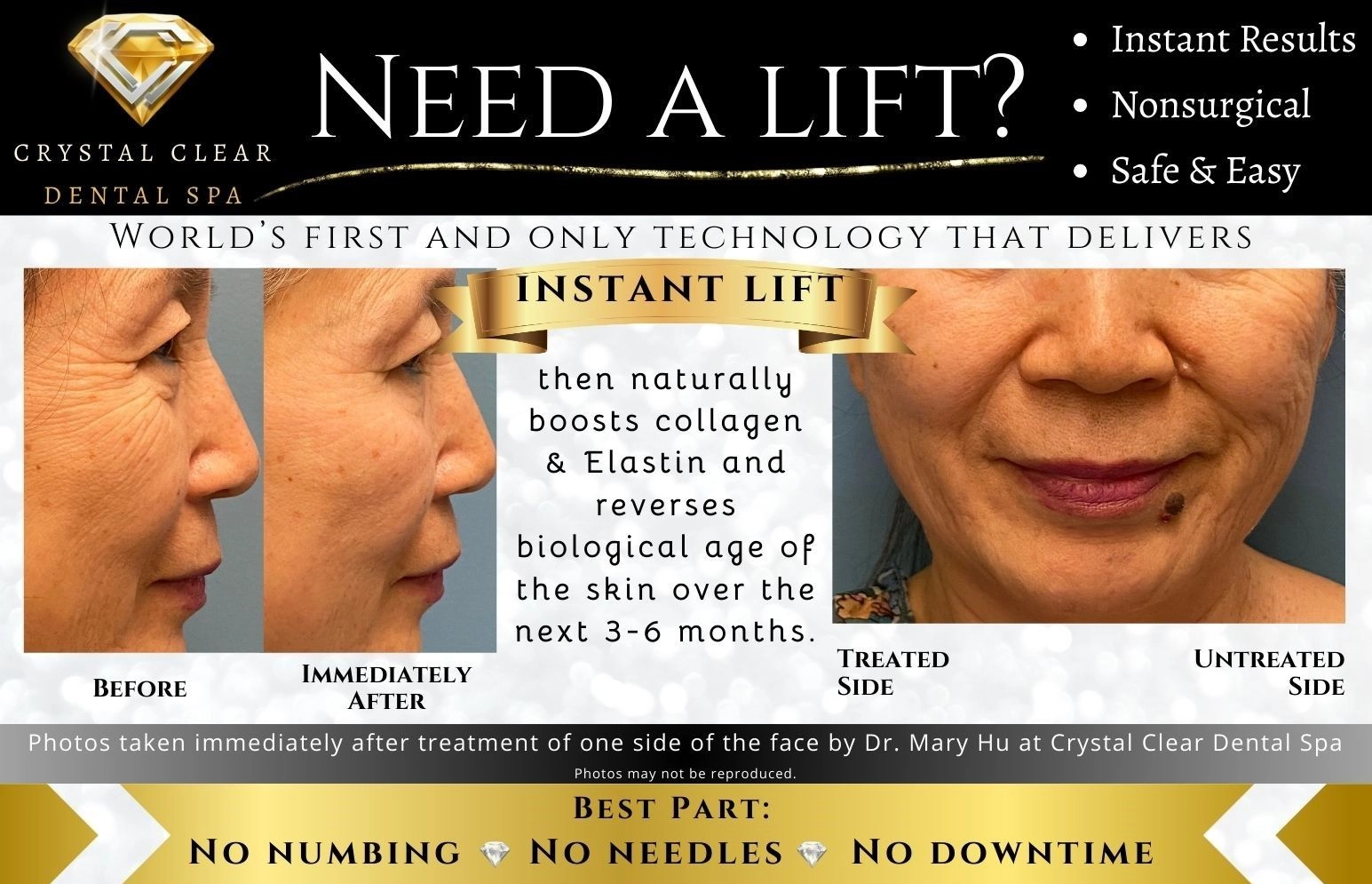 Special Offer 2 - Crystal Clear Dental Spa